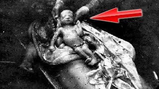 Erməni İşgəncə Növləri - Qarabağ Müharibesi Ermenistan Ve Azerbaycan Savaşı