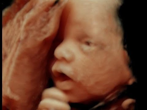 Vidéo: 25 Semaines De Grossesse : Sensations, Développement Fœtal