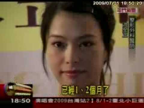 20090701 年代 184928 群英整形相關報導