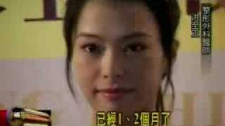 20090701 年代 184928 群英整形相關報導