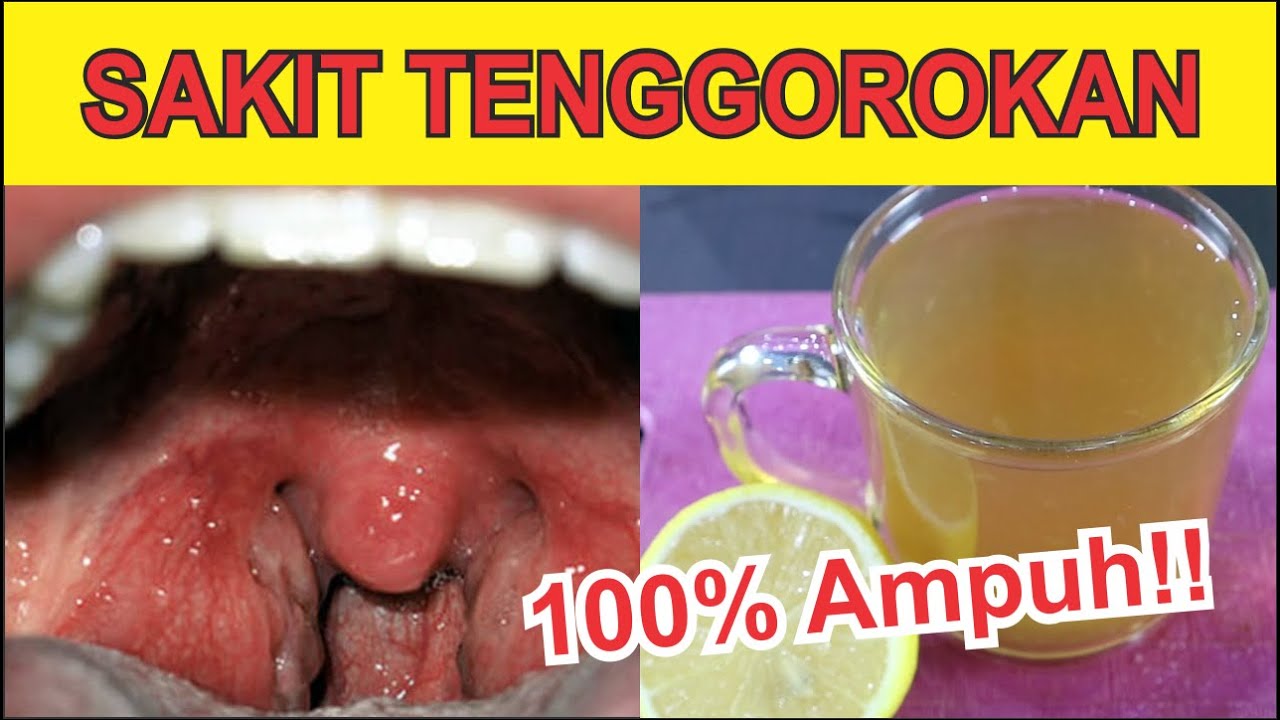 Tenggorokan Terasa Sakit Inilah Obatnya - Lemon Tea plus Madu