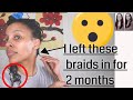 How To Take Down Mini Braids | No Breakage | 2 Months of New Growth