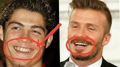 20+ Celebrities Before And After Braces 