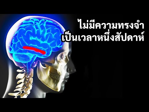 วีดีโอ: รายละเอียดที่สดใส