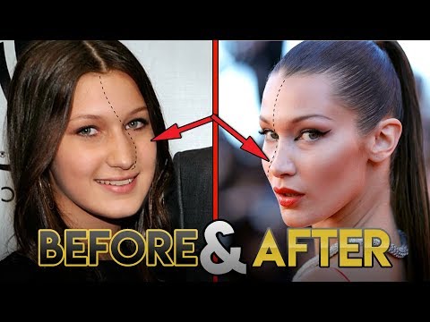 Video: Šta Je Bila Bella Hadid Prije Plastične Operacije