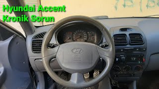 Direksiyon Sararmasına Derby Ile Basit Çözüm Hyundai Accent Otokolik