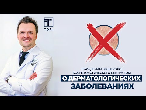 Врач-дерматовенеролог центра TORI Артём Проценко - о акне и прочих дерматологических заболеваниях