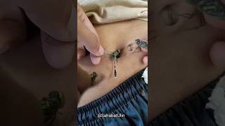 Terapi Capung Biar Ga Kencing Di Kasur Karena Beser Bestie