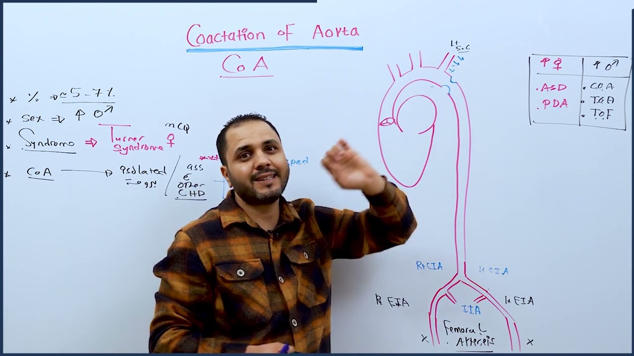 Coactation of Aorta - د.عبد الرحمن الجعكي
