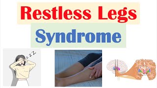 Restless Legs Syndrome Rls Causes, Signs & Symptoms, Diagnosis, Treatment