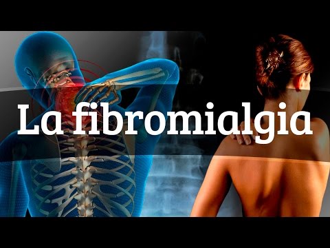 La fibromialgia - Causas, síntomas y tratamiento