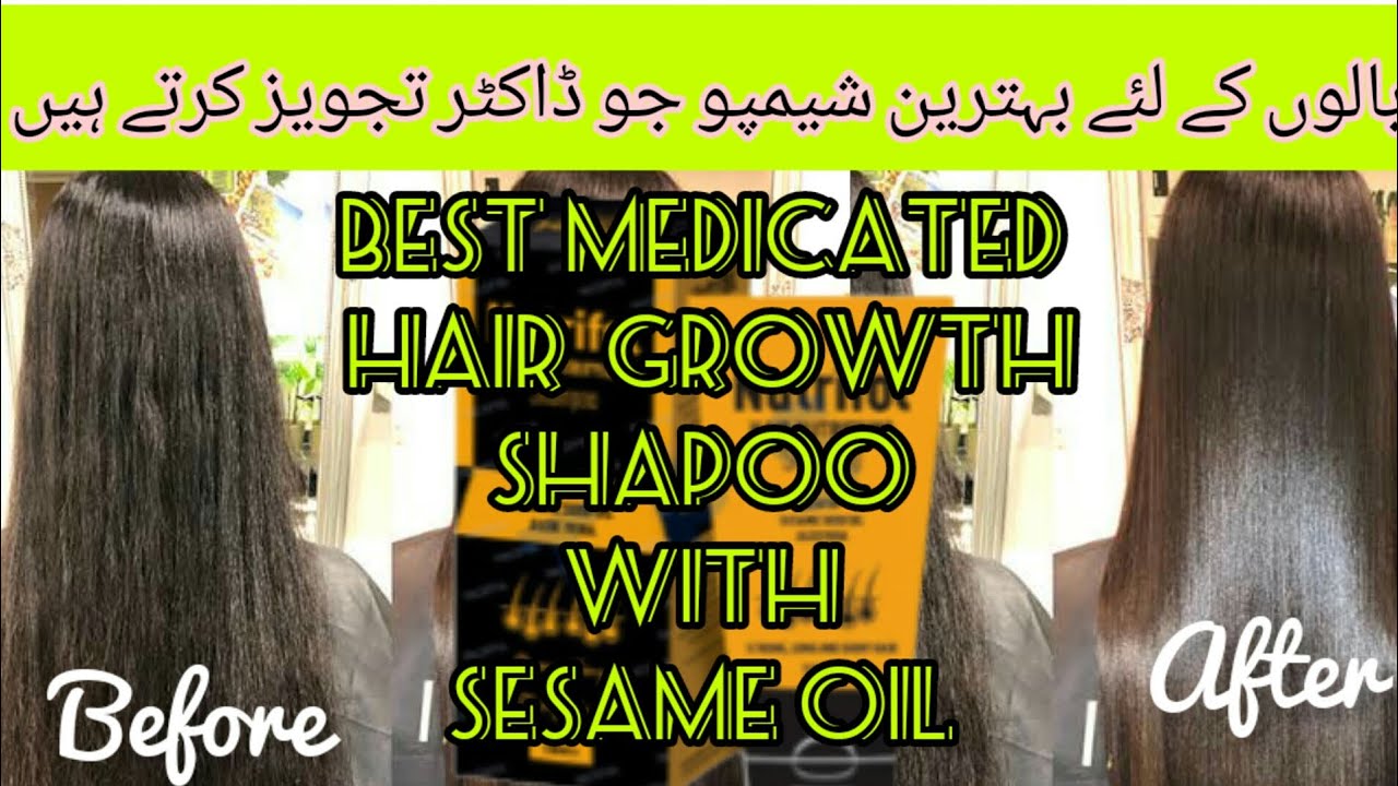 Best medicated Shampoo for oily scalp and demiged hair YouTube