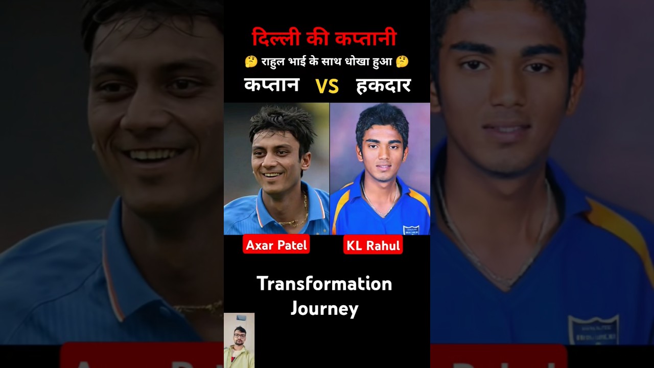 KL Rahul Vs Axar Patel 💯✅ age transformation journey//