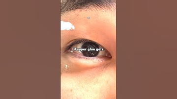 How to Survive SUPERGLUE in your EYE