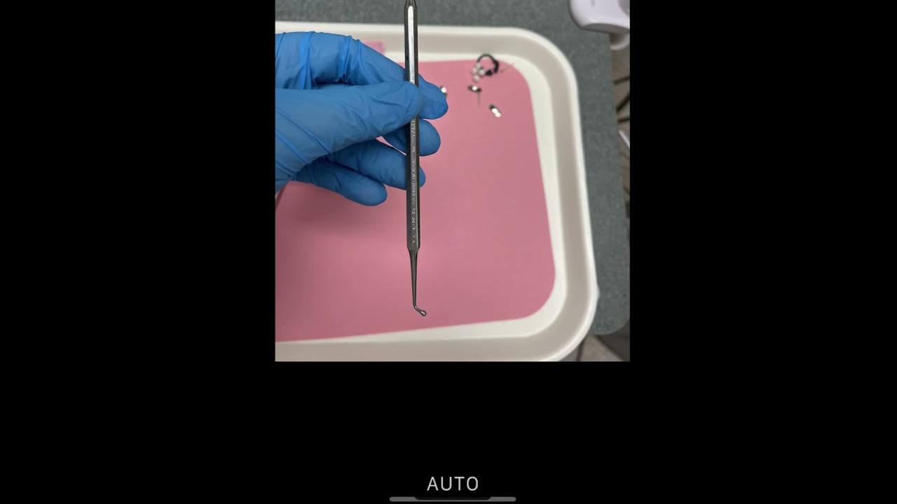 Amalgam Tray Set Up YouTube