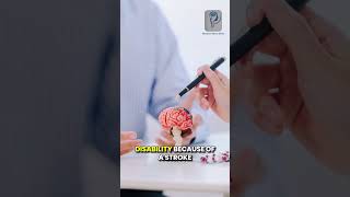 Every Second Counts Act FAST Against Stroke