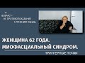 Миофасциальный синдром. Женщина 62 года.
