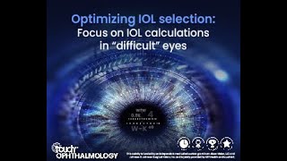Optimizing Iol Selection Focus On Iol Calculations In Difficult Eyes