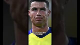 Editlerken Çok Çok Zorlandım Ironi