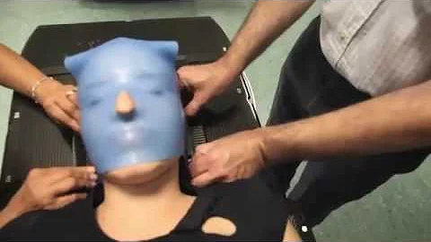Quali sono gli effetti collaterali della radioterapia al cervello?
