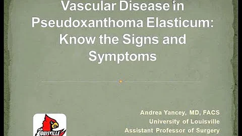 Vascular Disease in PXE: Know the Signs and Sympto...