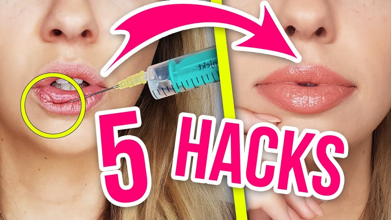 Lippen Selber Aufspritzen 5 Hacks Fur Volle Lippen Die Jeder Zu Hause Nachmachen Kann Youtube