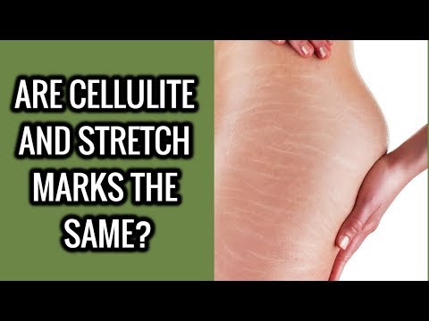 Best Home Remedies For Cellulite That Are All Natural