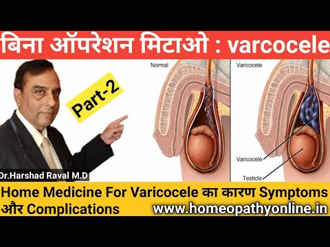 varicocele-का-परमानेंट-इलाज-l-100%-treatment-for-varicocele-l-best-home-treatment-for-varicocele