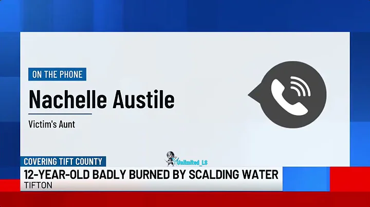 NEW: 12-year-old Georgia boy left with severe burns after his friends poured boiling water on him