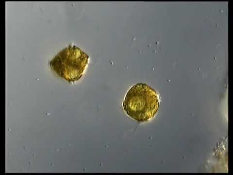 DINOFLAGELADO   DINOFLAGELLATE