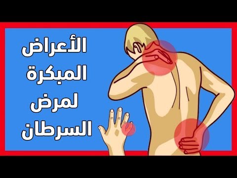 فيديو: كيفية معرفة أي نوع من الثور حفرة لدي