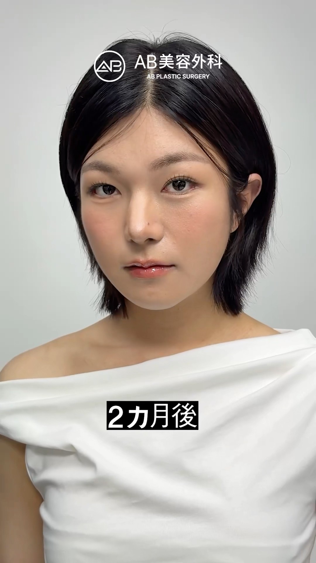 衝撃のビフォーアフター…顔がここまで変わる?! #shorts