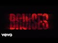 Download Mp3 Lewis Capaldi - Bruises (Lyric Video) Gudang lagu Download Mp3 Lewis Capaldi - Bruises (Lyric Video)