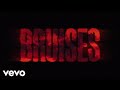 Lewis Capaldi - Bruises (Lyric Video)