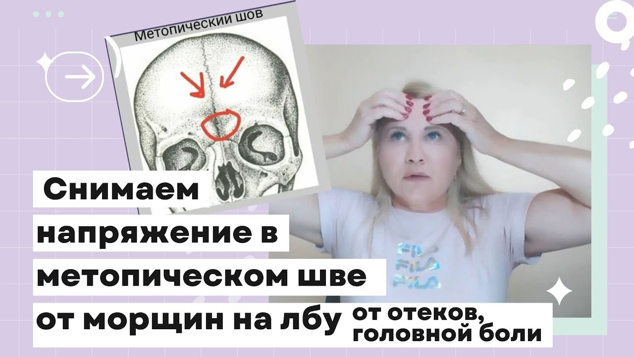 ☝️ Снимаем напряжение в метопическом шве от морщин на лбу, от отеков ...