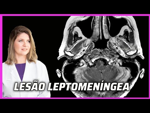 Vídeo: O que é “Lepto” e devo me preocupar com meu cachorro?