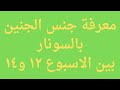 معرفة جنس الجنين بالسونار بين الاسبوع ١٢ و١٤ 