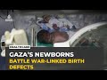 Gaza’s fragile survivors: Newborns battle war-linked birth defects