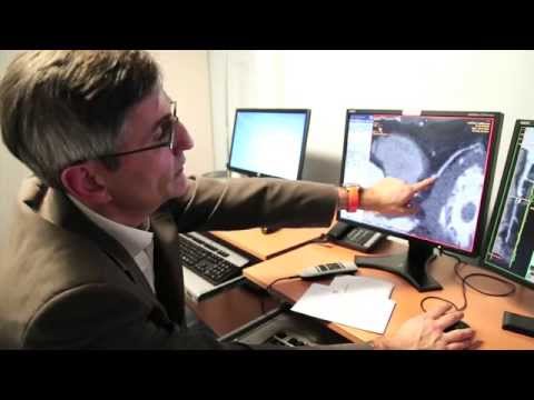 Video: Un Pic De Diagnostic Clinic