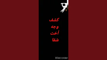 كشف وجه أخت شفا 