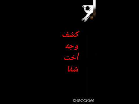 كشف وجه أخت شفا