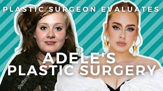 Plastic Surgeon Evaluates Adele at 33: Did Adele Have a Nose Job?