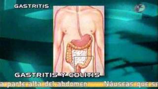 Dr Krasovsky - Gastritis &amp; colitis