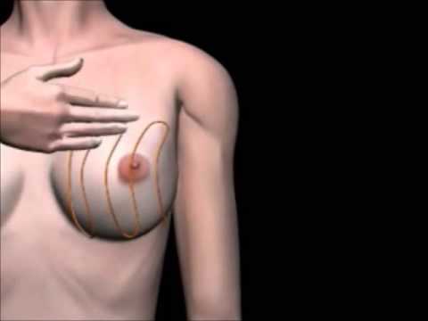 Βίντεο: Τι συντηρούσε στα στήθη
