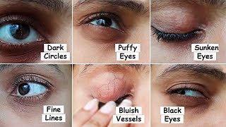 Best Eye Cream Treatment for DARK CIRCLES, Puffy Eyes, Sunken Eyes, Eye Wrinkles & Bluish Vessels