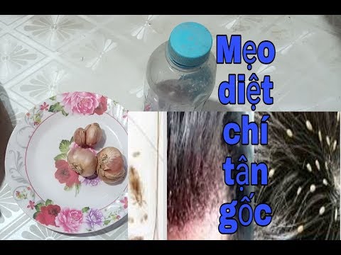 2 mẹo trị (chí )chấy rận trứng chấy tại nhà đơn giản hiệu quả sau 1 lần