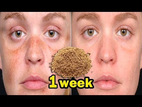 Skin Repair AND Close Large OPEN PORES in 1 week With This Kitchen Ingredient Remove Dark Spots