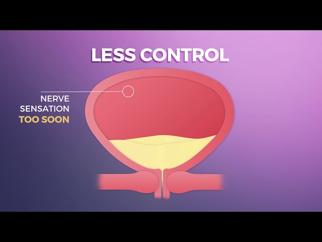 AZO Bladder Control Animation class=