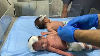Adorable Twin Babies 👶 | NICU Babies Emotional Moments 