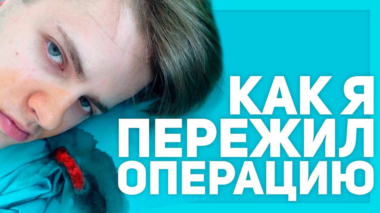 КАК Я ПЕРЕЖИЛ ОПЕРАЦИЮ? ВЫРЕЗАЛИ ГЛАНДЫ!